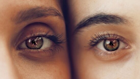 Círculos oscuros debajo de los ojos