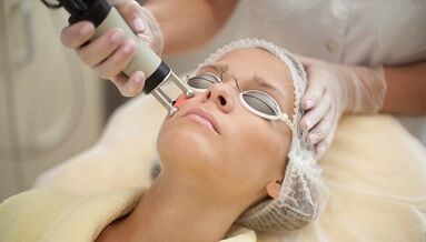 tipos de rejuvenecimiento facial fraccionado de la piel